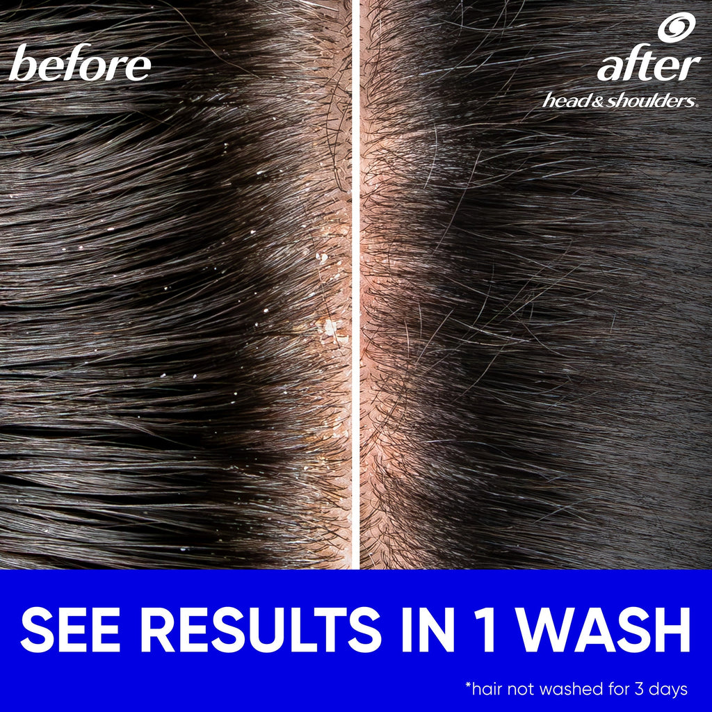 Head & Shoulders Green Apple 2 IN 1 Anti-Dandruff Shampoo & Conditioner, with Zinc Pyrithione