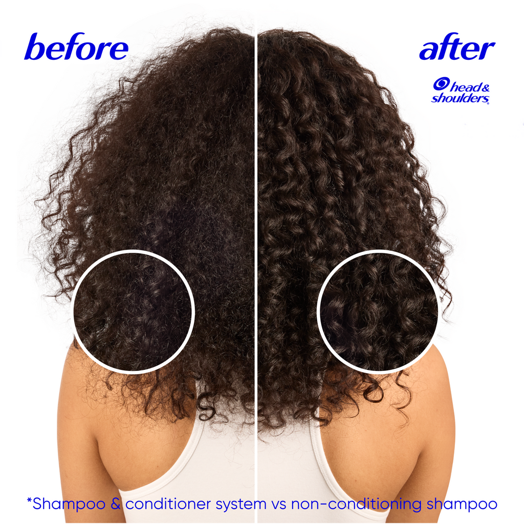 Deep Moisture Shea Butter Dandruff Shampoo, 24/7 Dandruff Protection, Zinc Pyrithione