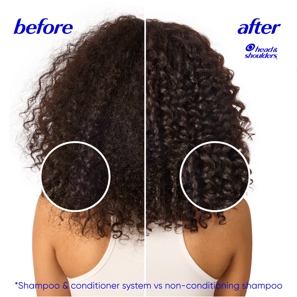 Hydrating Coconut 2 IN 1 Dandruff Shampoo & Conditioner, Zinc Pyrithione